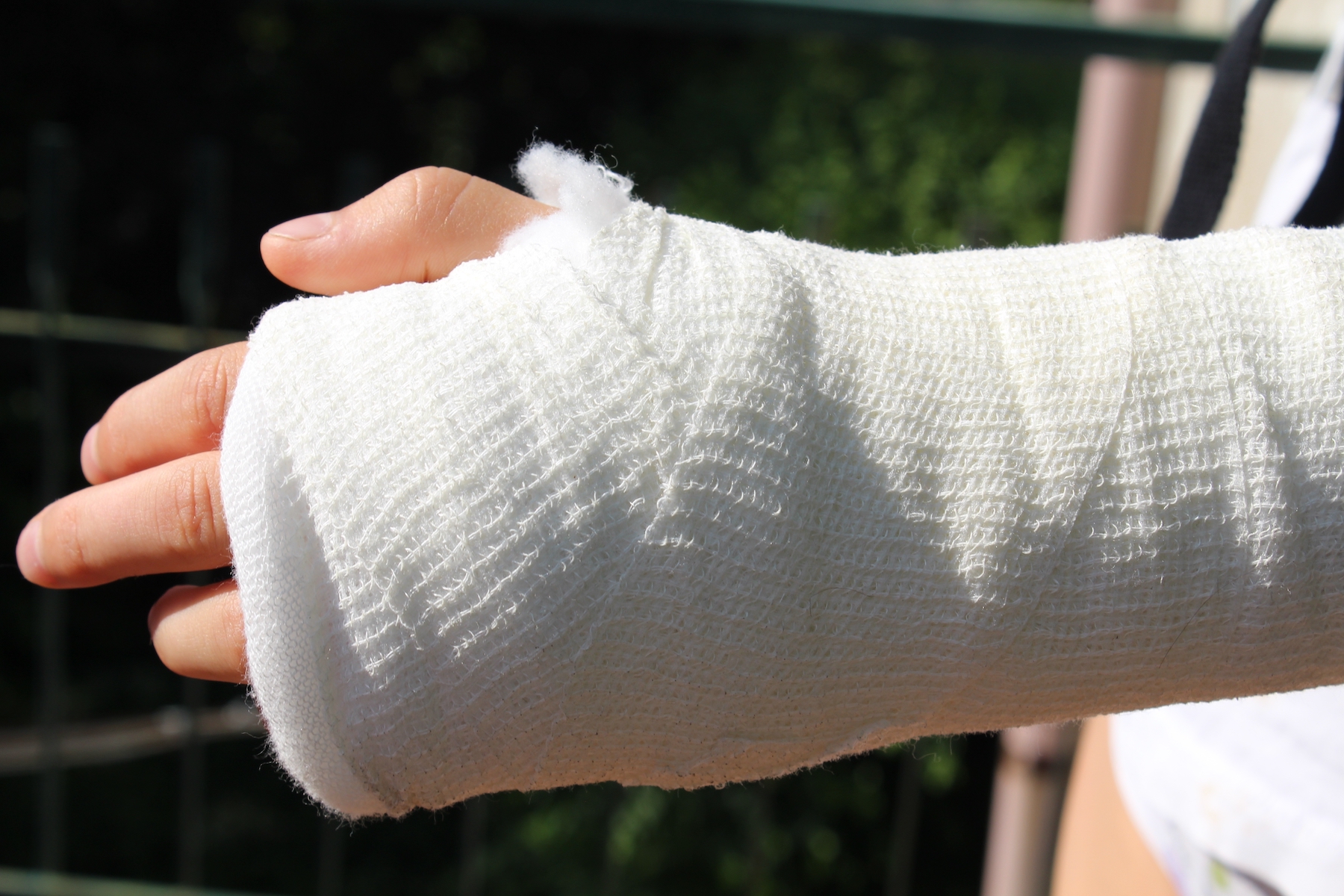 Baton rouge injury lawyers can help with claims for broken bones